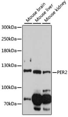 Western Blot: PER2 Antibody [NBP2-94809] - Analysis of extracts of various cell lines, using PER2 . Exposure time: 90s.