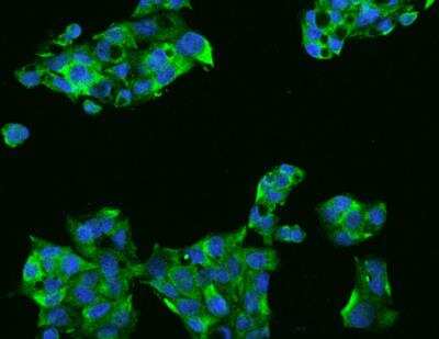 Immunocytochemistry/Immunofluorescence: PERK Antibody [NBP3-12585] - Staining of EIF2AK3 in HepG2 cells. Cells were fixed with 4% PFA, permeabilzed with 0.3% Triton X-100 in PBS,blocked with 10% serum, and incubated with rabbit anti-Human EIF2AK3 polyclonal antibody (dilution ratio 1:200) at 4? overnight. Then cells were stained with the Alexa Fluor®488-conjugated Goat Anti-rabbit IgG secondary antibody (green) and counterstained with DAPI (blue).Positive staining was localized to Cytoplasm.