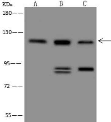 Western Blot: PERK Antibody [NBP3-12585] - Lane A: Hela Whole Cell LysateLane B: HepG2 Whole Cell LysateLane C: MCF-7 Whole Cell LysateLysates/proteins at 30 ug per lane.SecondaryGoat Anti-Rabbit IgG (H+L)/HRP at 1/10000 dilution.Developed using the ECL technique.Performed under reducing conditions.Predicted band size:125 kDaObserved band size:125 kDa(We are unsure as to the identity of these extra bands.)