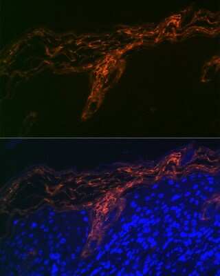 Immunohistochemistry: PERP Antibody (1O3L5) [NBP3-16617] - Immunofluorescence analysis of human skin cells using PERP Rabbit mAb (NBP3-16617) at dilution of 1:100 (40x lens). Blue: DAPI for nuclear staining.