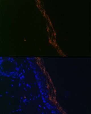 Immunohistochemistry: PERP Antibody (1O3L5) [NBP3-16617] - Immunofluorescence analysis of mouse skin cells using PERP Rabbit mAb (NBP3-16617) at dilution of 1:100 (40x lens). Blue: DAPI for nuclear staining.