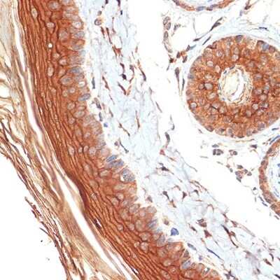 Immunohistochemistry-Paraffin: PERP Antibody (1O3L5) [NBP3-16617] - Immunohistochemistry of paraffin-embedded rat skin using PERP Rabbit mAb (NBP3-16617) at dilution of 1:100 (40x lens).Perform microwave antigen retrieval with 10 mM Tris/EDTA buffer pH 9.0 before commencing with IHC staining protocol.