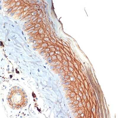 Immunohistochemistry-Paraffin: PERP Antibody (1O3L5) [NBP3-16617] - Immunohistochemistry of paraffin-embedded mouse skin using PERP Rabbit mAb (NBP3-16617) at dilution of 1:100 (40x lens).Perform microwave antigen retrieval with 10 mM Tris/EDTA buffer pH 9.0 before commencing with IHC staining protocol.