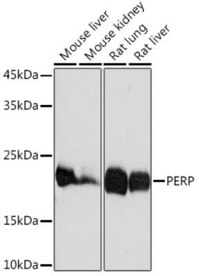 Western Blot: PERP Antibody (1O3L5) [NBP3-16617] - Western blot analysis of extracts of various cell lines, using PERP Rabbit mAb (NBP3-16617) at 1:1000 dilution. Secondary antibody: HRP Goat Anti-Rabbit IgG (H+L) at 1:10000 dilution. Lysates/proteins: 25ug per lane. Blocking buffer: 3% nonfat dry milk in TBST. Detection: ECL Basic Kit. Exposure time: 1s.