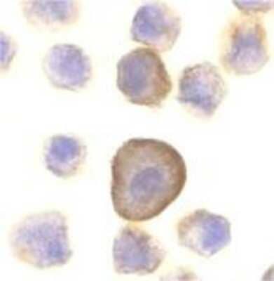 Immunocytochemistry/Immunofluorescence: PERP Antibody [NBP1-76741] - Immunocytochemical analysis of PERP in formalin-fixed A431 cells with PERP antibody at 10 ug/ml.