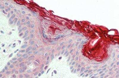 Immunohistochemistry-Paraffin: PERP Antibody [NB100-2912] - Human Skin. Steamed antigen retrieval with citrate buffer pH 6, AP-staining.