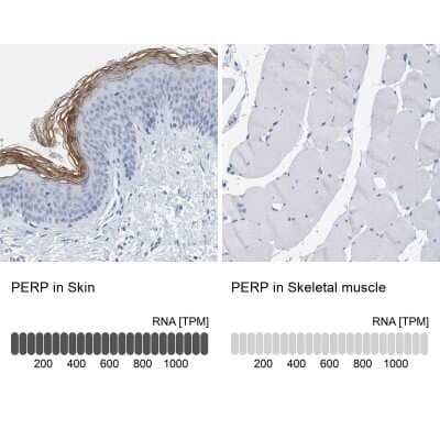 Immunohistochemistry-Paraffin: PERP Antibody [NBP1-85173] - Analysis in human skin and skeletal muscle tissues. Corresponding PERP RNA-seq data are presented for the same tissues.