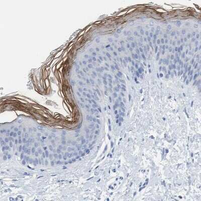 Immunohistochemistry-Paraffin: PERP Antibody [NBP1-85173] - Staining of human skin shows moderate to strong membranous positivity in stratum corneum.