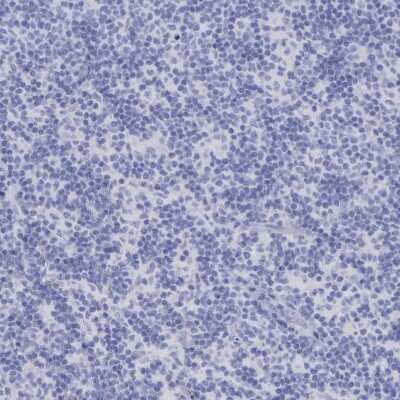 Immunohistochemistry-Paraffin: PERP Antibody [NBP1-85173] - Staining of human lymph node shows no positivity as expected.