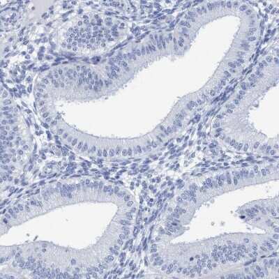 Immunohistochemistry-Paraffin: PERP Antibody [NBP1-85173] - Staining of human endometrium shows no positivity as expected.