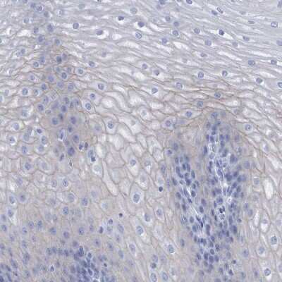 Immunohistochemistry-Paraffin PERP Antibody