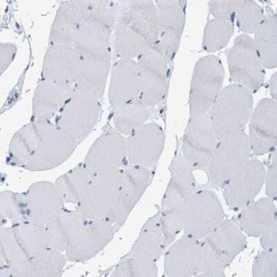 Immunohistochemistry-Paraffin: PERP Antibody [NBP1-85173] - Staining of human skeletal muscle shows no positivity as expected.