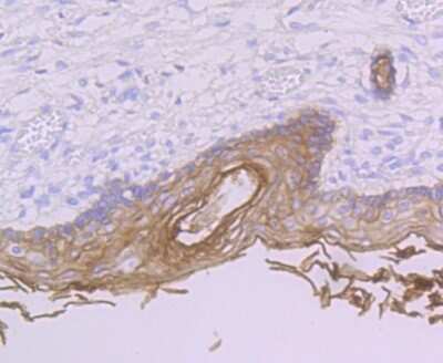 Immunohistochemistry-Paraffin: PERP Antibody (JU04-51) [NBP2-75616] - Analysis of paraffin-embedded human skin tissue using anti-PERP antibody. Counter stained with hematoxylin.