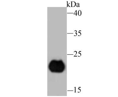 Western Blot: PERP Antibody (JU04-51) [NBP2-75616] - Analysis of PERP on human skin tissue lysate using anti-PERP antibody at 1/1,000 dilution.