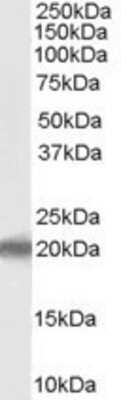 Western Blot: PERP Antibody [NB100-2912] - (1ug/ml) staining of human liver lysate (35ug protein in RIPA buffer). Primary incubation was 1 hour. Detected by chemiluminescence.