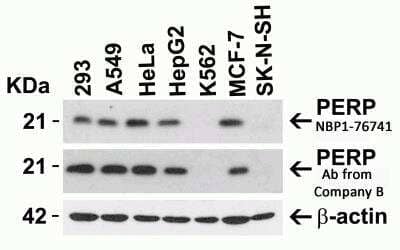 <b>Independent Antibodies Validation. </b>Western Blot: PERP Antibody [NBP1-76741] - Independent Antibody Validation via Protein Expression Profile in Human Cell Lines. Loading: 15 ug lysates per lane. Antibodies: PERP NBP1-76741 (1ug/ml), PERP antibody from Company B (2 ug/ml), beta-actin NBP1-76692 (1 ug/ml) and GAPDH (0.02 ug/ml), 1h incubation at RT in 5% NFDM/TBST. Secondary: Goat anti-rabbit IgG HRP conjugate at 1:10000 dilution.