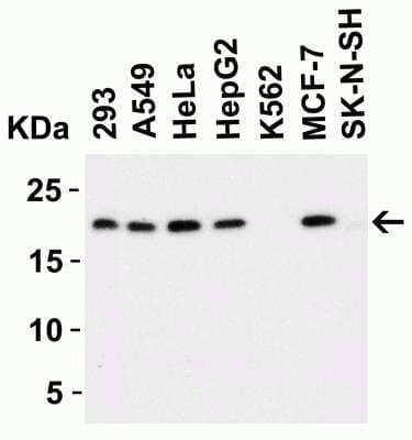 Western Blot: PERP Antibody [NBP1-76741] - Western Blot Validation in Human Cell Lines. Loading: 15 ug of lysates per lane. Antibodies: PERP NBP1-76741 (1 ug/mL), 1h incubation at RT in 5% NFDM/TBST.Secondary: Goat anti-rabbit IgG HRP conjugate at 1:10000 dilution.