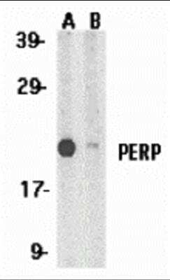 Western Blot PERP Antibody - BSA Free