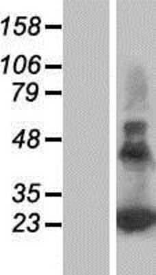 Western Blot PERP Overexpression Lysate