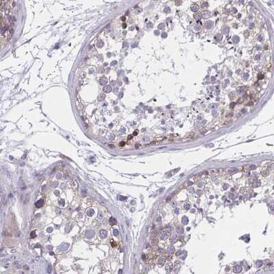 Immunohistochemistry-Paraffin PERQ2 Antibody - BSA Free