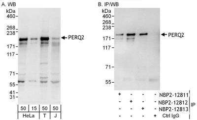 Immunoprecipitation: PERQ2 Antibody [NBP2-12813] - Samples:  Whole cell lysate from HeLa (15 and 50 ug for WB; 1 mg for IP, 20% of IP loaded), 293T (T; 50 ug) and Jurkat (J; 50 ug) cells.  Antibodies: Affinity purified rabbit anti-PERQ2 antibody NBP2-12811 used for WB at 0.1 ug/ml (A) and 1 ug/ml (B) and used for IP at 6 ug/mg lysate.  PERQ2 was also immunoprecipitated by rabbit anti-PERQ2 antibodies NBP2-12812 and NBP2-12813, which recognize downstream epitopes.  Detection: Chemiluminescence with exposure times of 10 seconds (A and B).