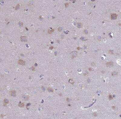 Immunohistochemistry-Paraffin PET117 Antibody - BSA Free