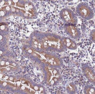 Immunohistochemistry-Paraffin PET117 Antibody - BSA Free