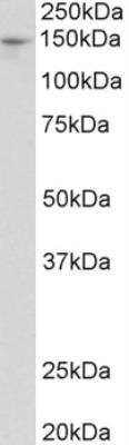 Western Blot: PEX1 Antibody [NBP1-49881] - Staining of Mouse Liver lysate (35 ug protein in RIPA buffer). Primary incubation was 1 hour. Detected by chemiluminescence.  