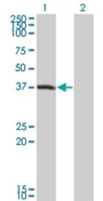 Western Blot: PEX10 Antibody (1B8) [H00005192-M01] - Analysis of PEX10 expression in transfected 293T cell line by PEX10 monoclonal antibody (M01), clone 1B8.Lane 1: PEX10 transfected lysate(37.069 KDa).Lane 2: Non-transfected lysate.