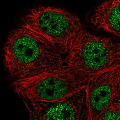 Immunocytochemistry/Immunofluorescence: PEX10 Antibody [NBP2-58492] - Staining of human cell line MCF7 shows localization to nucleoplasm.