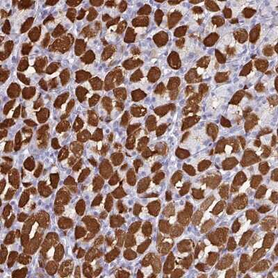 Immunohistochemistry: PEX10 Antibody [NBP2-48945] - Staining of human stomach, lower shows strong cytoplasmic positivity in glandular cells.