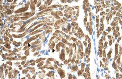 Immunohistochemistry-Paraffin: PEX10 Antibody [NBP1-59745] - Human Muscle Tissue, Skeletal muscle cells (Indicated with Arrows) 4-8ug/ml.