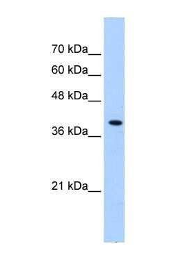 Western Blot: PEX10 Antibody [NBP1-59745] - Transfected 293T, Antibody Titration: 0.2-1 ug/ml