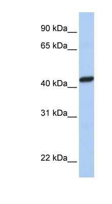 Western Blot: PEX10 Antibody [NBP1-60050] - MCF-7 whole cell lysates, concentration 0.2-1 ug/ml.