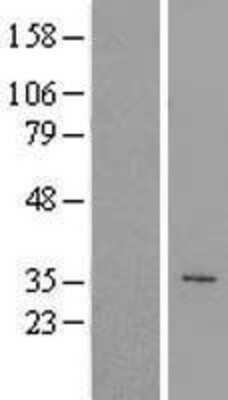 Western Blot: PEX10 Overexpression Lysate (Adult Normal) [NBL1-14292] Left-Empty vector transfected control cell lysate (HEK293 cell lysate); Right -Over-expression Lysate for PEX10.