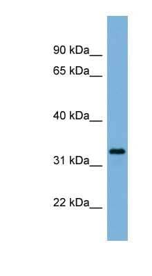 Western Blot: PEX11A Antibody [NBP1-59704] - OVCAR-3 cell lysate, concentration 0.2-1 ug/ml.