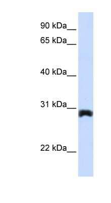 Western Blot: PEX11A Antibody [NBP1-59705] - Titration: 0.2-1 ug/ml, Positive Control: Human Placenta.