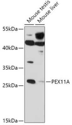 Western Blot: PEX11A Antibody [NBP2-94259] - Analysis of extracts of various cell lines, using PEX11A at 1:1000 dilution. Secondary antibody: HRP Goat Anti-Rabbit IgG (H+L) at 1:10000 dilution. Lysates/proteins: 25ug per lane. Blocking buffer: 3% nonfat dry milk in TBST. Detection: ECL Basic Kit . Exposure time: 60s.