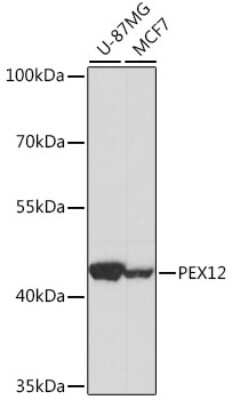 Western Blot: PEX12 Antibody [NBP2-93666] - Analysis of extracts of various cell lines, using PEX12 at 1:1000 dilution. Secondary antibody: HRP Goat Anti-Rabbit IgG (H+L) at 1:10000 dilution. Lysates/proteins: 25ug per lane. Blocking buffer: 3% nonfat dry milk in TBST. Detection: ECL Basic Kit . Exposure time: 3s.