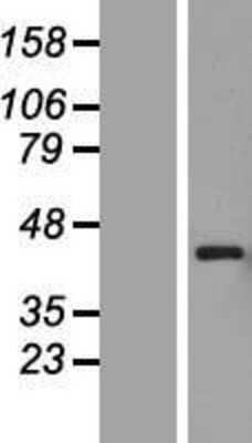 Western Blot: PEX12 Overexpression Lysate (Adult Normal) [NBL1-14296] Left-Empty vector transfected control cell lysate (HEK293 cell lysate); Right -Over-expression Lysate for PEX12.