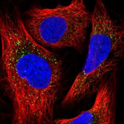 Immunocytochemistry/Immunofluorescence: PEX13 Antibody [NBP2-38204] - Staining of human cell line U-2 OS shows localization to vesicles.