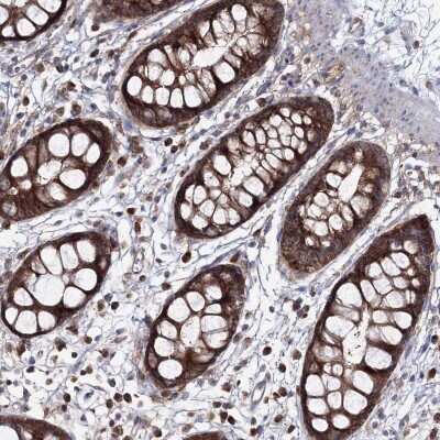 Immunohistochemistry: PEX13 Antibody [NBP2-38204] - Staining of human rectum shows strong granular cytoplasmic positivity in glandular cells.