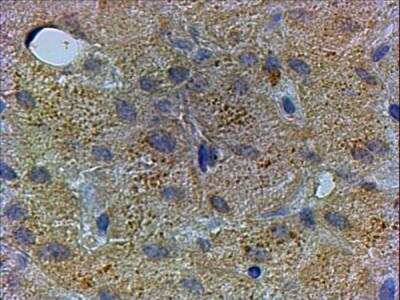 Immunohistochemistry-Paraffin: PEX13 Antibody [NB100-1208] - Analysis of human Liver shows vesicular staining in the cytoplasm of the hepatocytes.