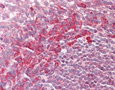 Immunohistochemistry-Paraffin: PEX13 Antibody [NBP1-31032] - Paraffin-embedded placenta. PEX13 antibody [C3], C-term  dilution: 1:100.