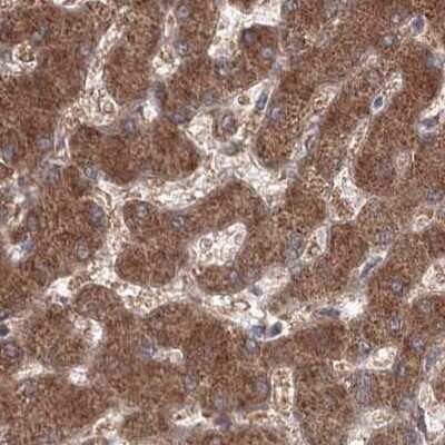 Immunohistochemistry-Paraffin: PEX13 Antibody [NBP1-86321] - Staining of human liver.