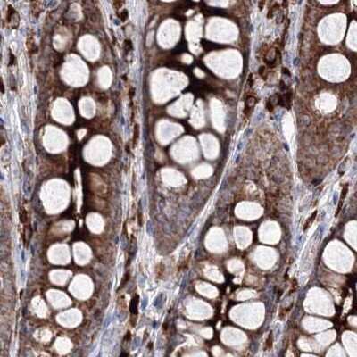 Immunohistochemistry-Paraffin: PEX13 Antibody [NBP1-86321] - Staining of human colon.