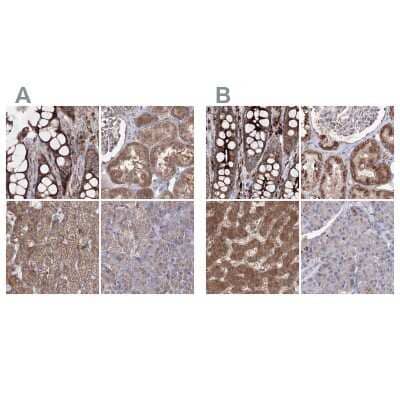 <b>Independent Antibodies Validation. </b>Immunohistochemistry-Paraffin: PEX13 Antibody [NBP2-38204] - Staining of human colon, kidney, liver and pancreas using Anti-PEX13 antibody NBP2-38204 (A) shows similar protein distribution across tissues to independent antibody NBP1-86321 (B).