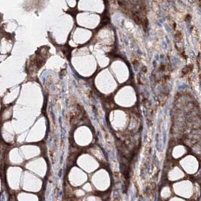 Immunohistochemistry-Paraffin: PEX13 Antibody [NBP2-38204] - Staining of human colon.