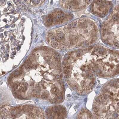 Immunohistochemistry-Paraffin: PEX13 Antibody [NBP2-38204] - Staining of human kidney.