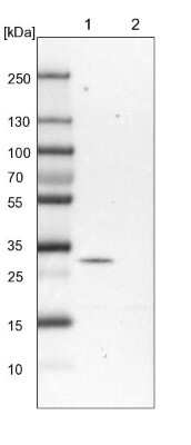 Western Blot: PEX16 Antibody [NBP1-85828] - Lane 1: Mouse liver tissue lysate Lane 2: Rat liver tissue lysate